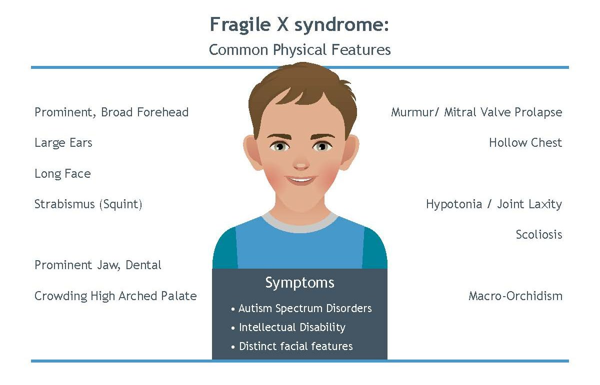 Genetic diagram showing X-linked inheritance pattern of Fragile X syndrome with CGG repeat expansion in FMR1 gene