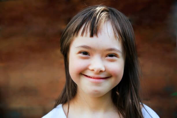 Young child with Down syndrome showing characteristic facial features including upward slanting eyes and flat nasal bridge